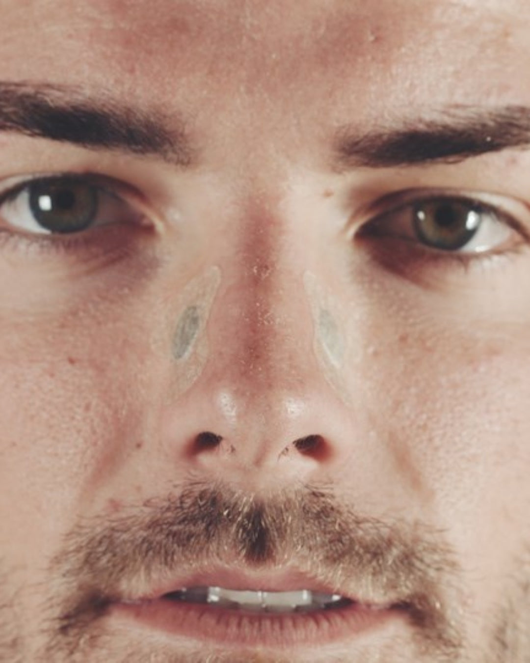 Aimant nasal magnétique Asterisk AC - 3 niveaux